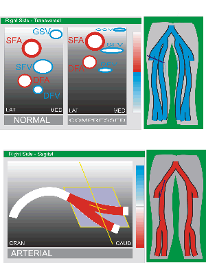 Arterial examination