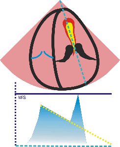 Echocardiography